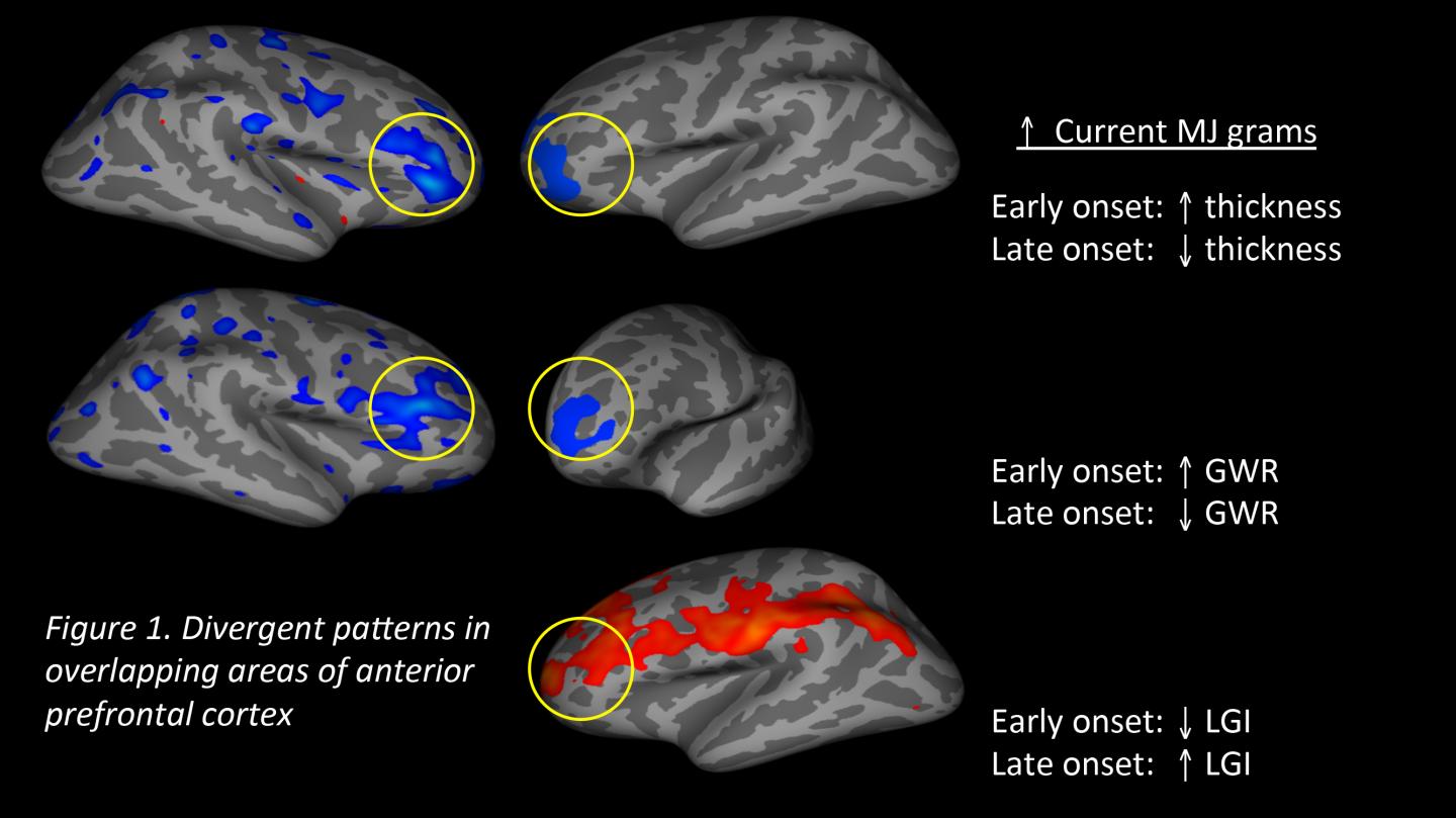 Brain Imaging Patterns in the Prefrontal Cortex