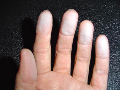Hand