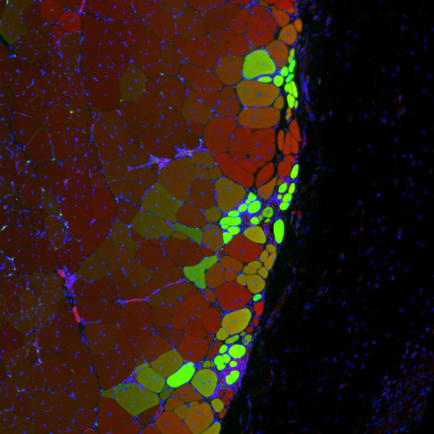 New Muscle Strands Thanks to Nanohydrogel with MuSC
