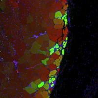 New Muscle Strands Thanks to Nanohydrogel with MuSC