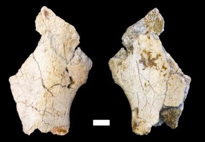 Upper Hip Bone