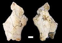Upper Hip Bone