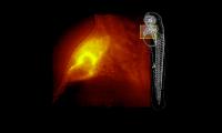 Heart of a Zebrafish