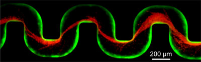 Bacterial Clogging