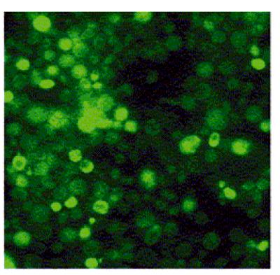 Biosensor