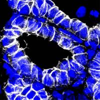 Post-partum mouse mammary gland