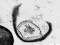 Burst Open Cell with Phages Escaping