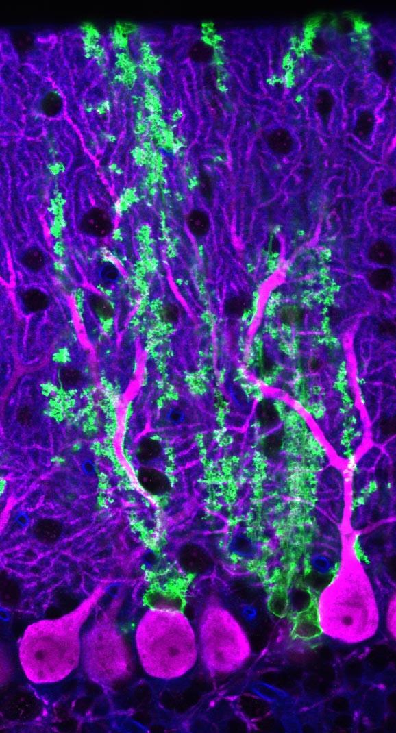 Neighboring Neurons Dictate the Role of Astrocytes (1 of 2)