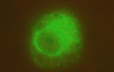 siRNA (2 of 2)