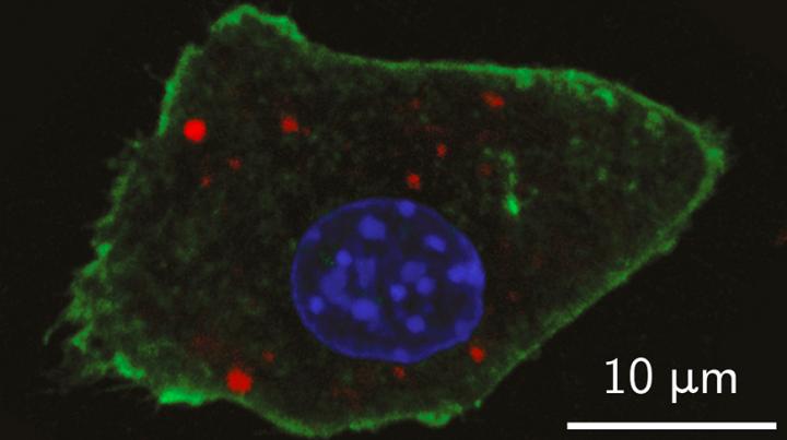 Detection of nanoparticle contrast agents