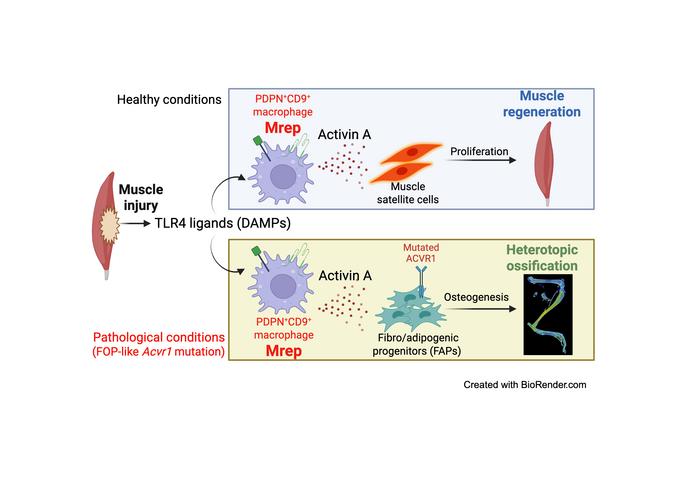 A novel macrophage subset Mrep for muscle regeneration and heterotopic ossification in FOP