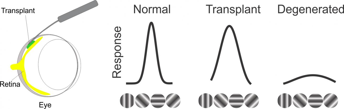 Retinal Sheet Transplant