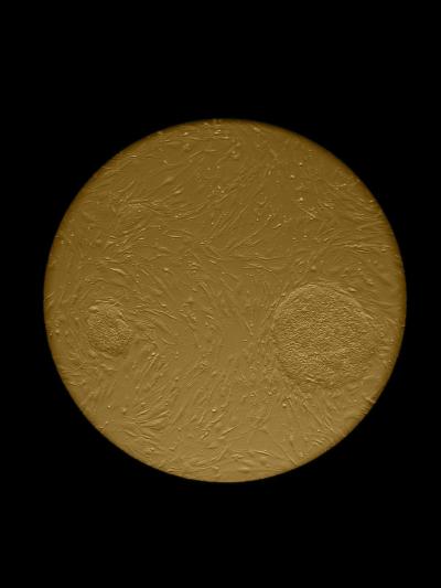 Human Embryonic Stem Cell Colonies