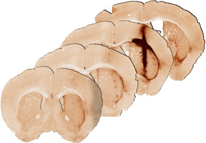 Mouse brain tissue 28 days after injection of hydrogel with myoglobin