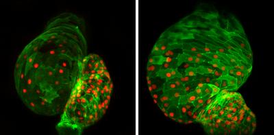 Cardiac Development out of Control