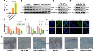 NaCl disrupts skin barrier function in atopic dermatitis and suppresses keratinocyte differentiation.