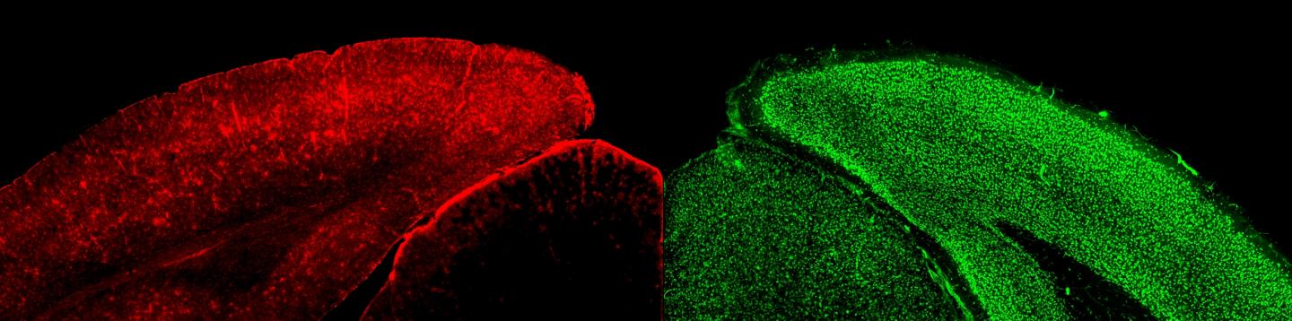 Astrocytes vs. Neurons