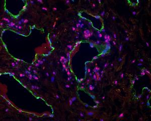 Lymph Vessels