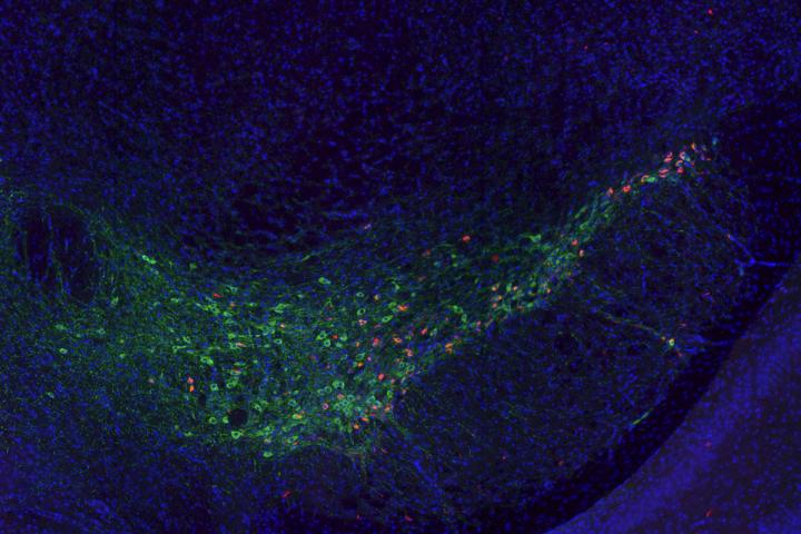 Neurons with Alpha-Synuclein