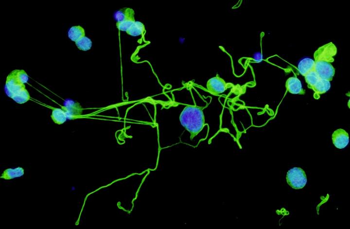 3-D Engineered Bone Marrow Makes Functioning Platelets