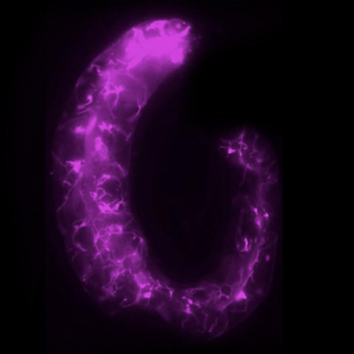 Tubular Lysosomes