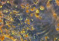Heart Cells Under Reduced Oxygen Conditions