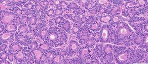 In Switzerland, colorectal cancer is increasing among people under 50