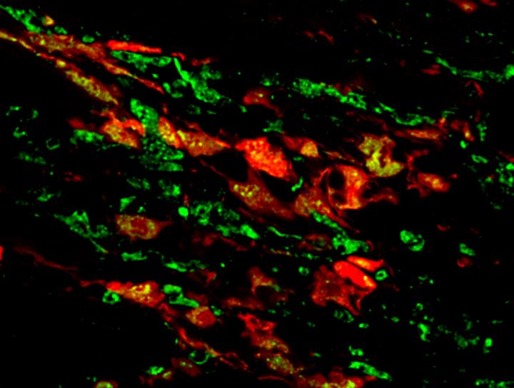 Fibroblasts