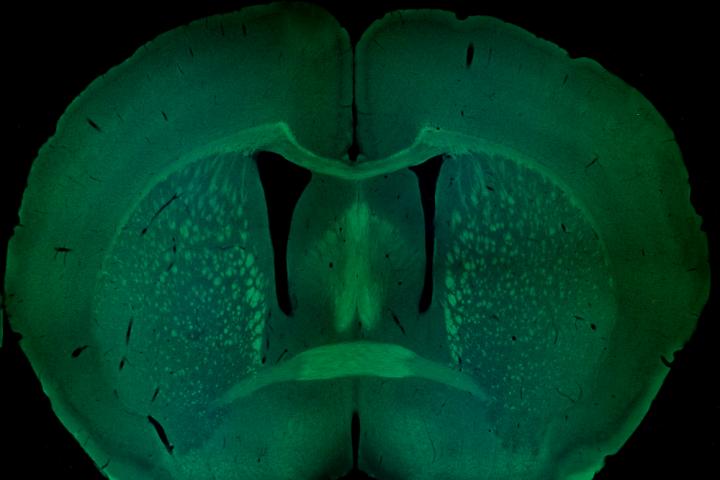 Coronal section of mouse brain