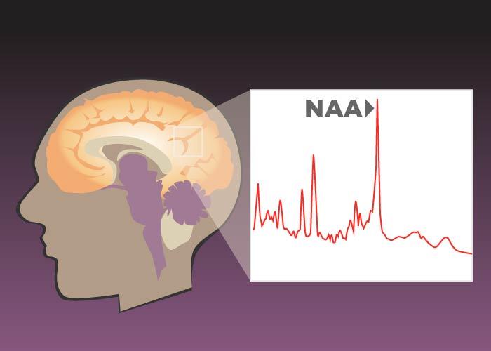 Brain Chemistry and Fluid Intelligence