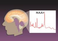 Brain Chemistry and Fluid Intelligence
