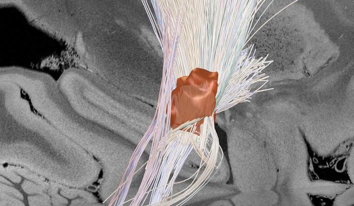 Focused ultrasound imaging