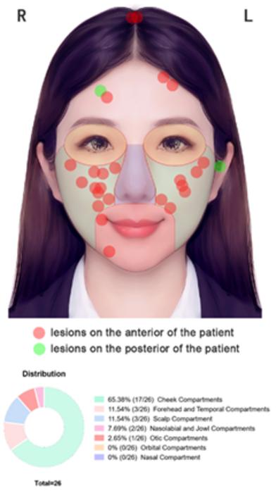 Dermatofibrosarcoma protuberans. Representative illustration showing distribution of the lesions on the head and face in patients