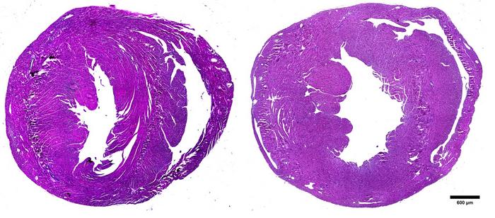 Advancing new heart failure therapies