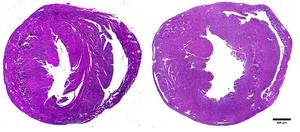 Advancing new heart failure therapies
