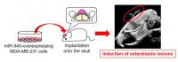 Fig.2  Cancer-secreted hsa-miR-940 Induces Osteoblastic Lesions in the Bone Microenvironment