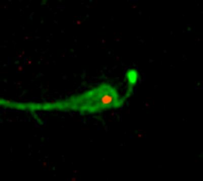 Developing Neurons Leave Their Footprints (2 of 4)