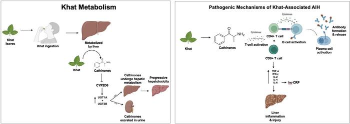 Khat-associated Autoimmune Hepatitis