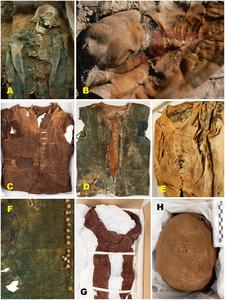 Skeletons in the permafrost: Exploring climate-driven heritage loss and occupational health at the early modern whaling burial site of Likneset, Svalbard