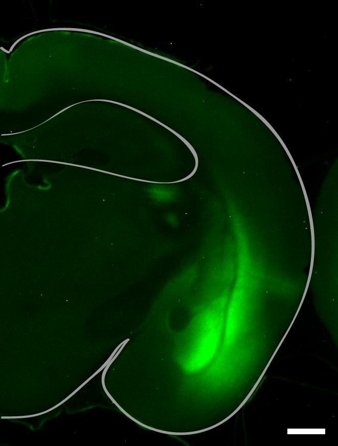 Mouse Brain