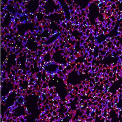 Lung Tissue
