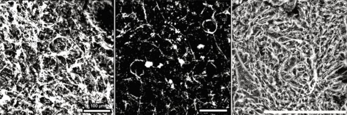 SGLT2 inhibitors maintain youthful capillaries