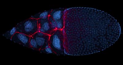 Researchers Have a Better Idea of How Cancer Cells Move and Grow