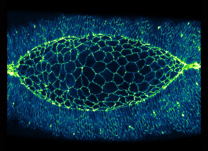 MBI YT Amnioserosa (1 of 2)