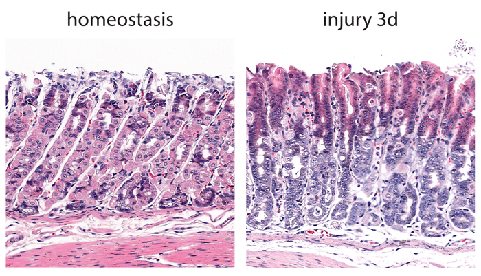 NT vs injury H&E
