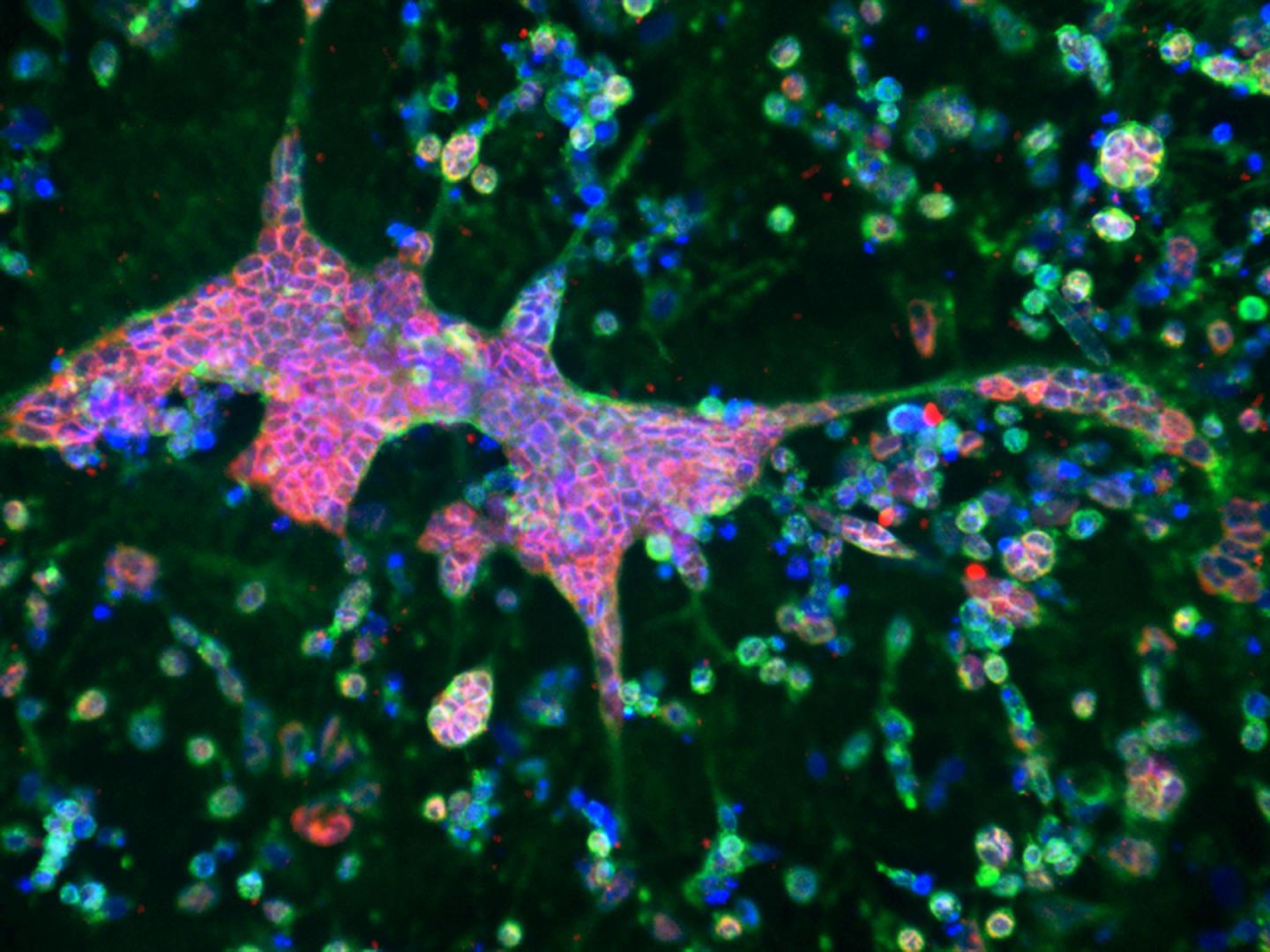 3D Brain Tissue Model Showing Features of Alzheimer's Disease