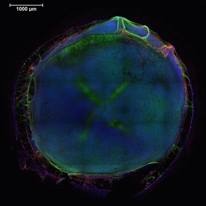 Neural Tissue