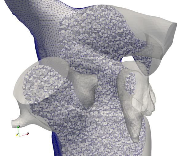 Image of iHEART Project
