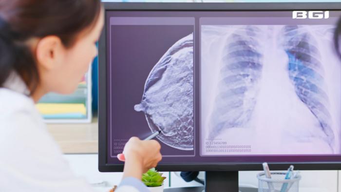 Mammograms remain gold standard in breast cancer diagnosis.
