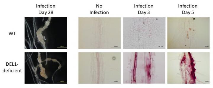 Lignin accumulation in wild type and DEL1 deficient plants